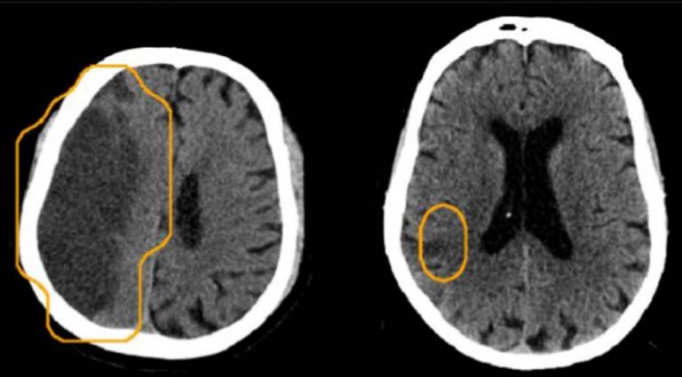 red dot® CT Head Day and Night reporting Case Study – Behold.ai